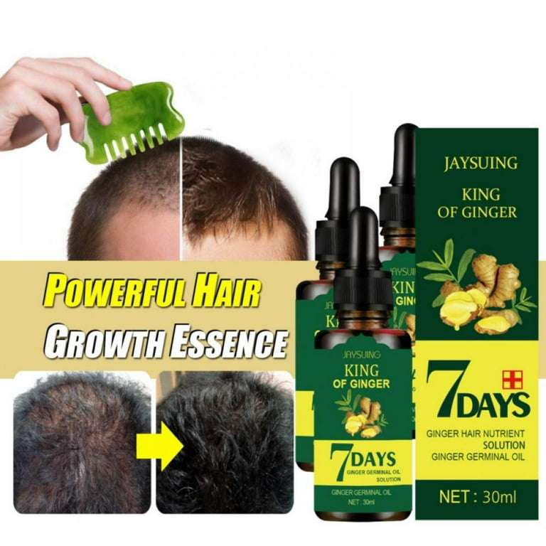 Jaysuing King of Ginger 7 Days Ginger Hair Growth Essene Oil For Damaged Hair - 30ml