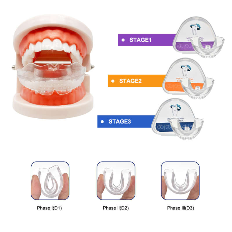 Multi Functional Invisible Braces Orthodontic Teeth Trainer & Alignment - 3 Stage Kit