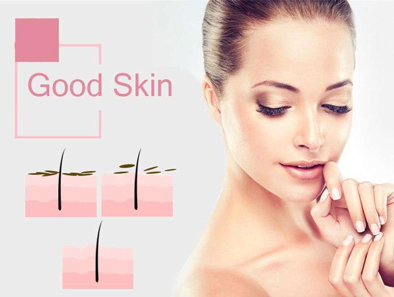 XN-8030 Beautiful Skin Care Expert Acne Pore Cleaner Acne skin care Removal Acne Professional Device Quick Solution
