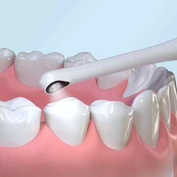 TIMESISO T5-YPC Oral Cavity Visualization 1080P HD Camera Real-time Synchronization Dental Mirror