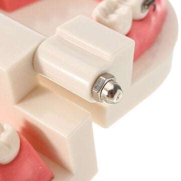 Dental Teeth Malocclusion Orthodontic Model With Full Metal Brackets Hoops Dentist Teaching