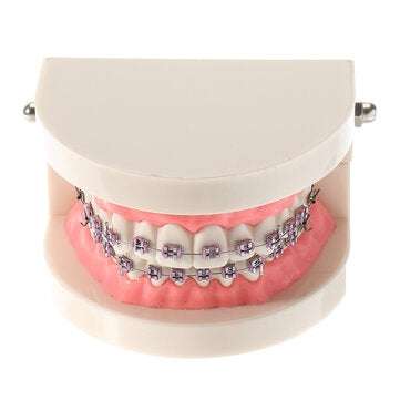 Dental Teeth Malocclusion Orthodontic Model With Full Metal Brackets Hoops Dentist Teaching