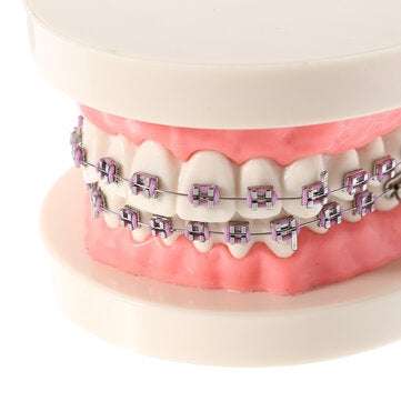 Dental Teeth Malocclusion Orthodontic Model With Full Metal Brackets Hoops Dentist Teaching