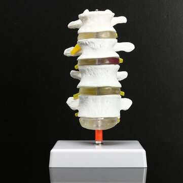 4 Part Chiropractic Human Anatomical Lumbar Vertebrae Spine Anatomy Medical Model