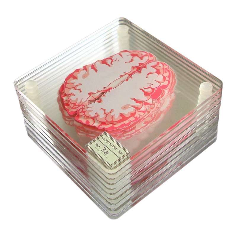 Brain Specimen Coasters Set 3D Organ Brain Artwork Brain Slices Square Acrylic Drinks Table Coaster