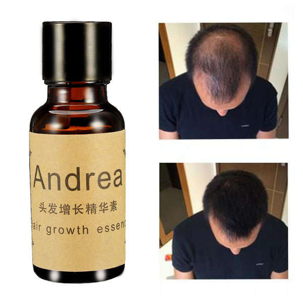 Fast Hair Growth Essence Liquid Pilatory For Men And Women 20ml