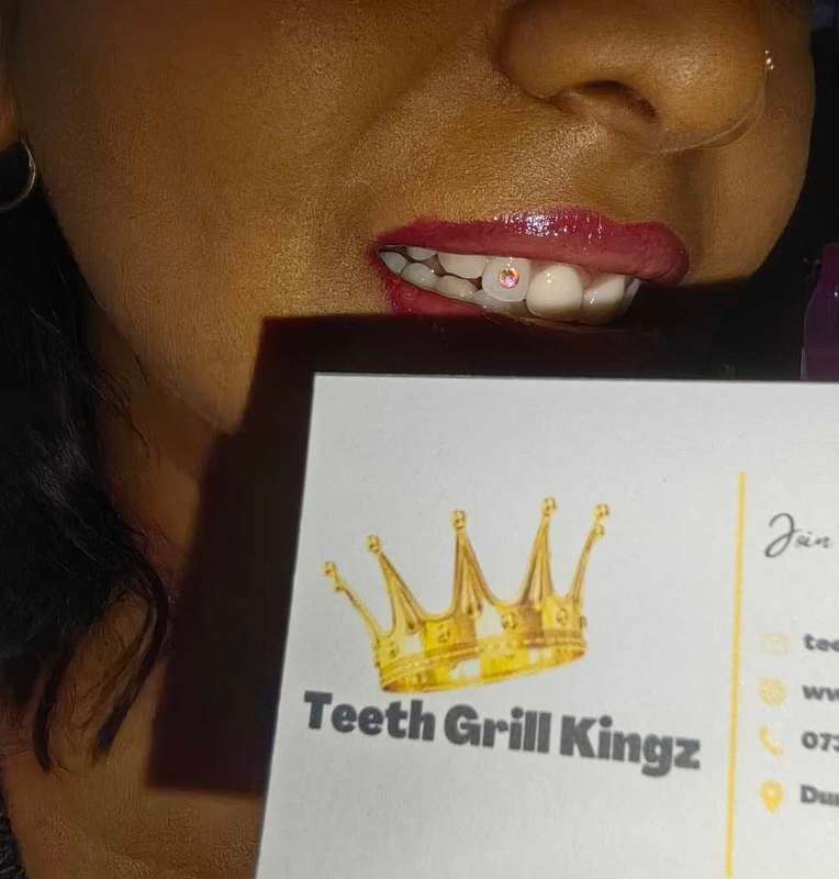 Tooth Gemstone DIY Kit