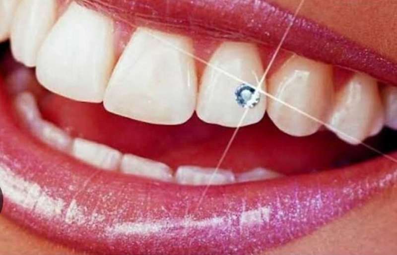 Tooth Gemstone DIY Kit