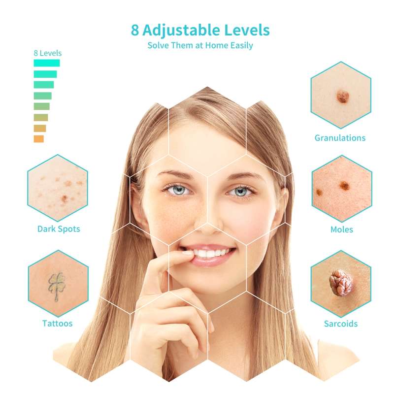 Xpreen XPRE061 Professional Dark Spot Remover Freckle Tattoo Chargeable Wart Mole Remover, with LED
