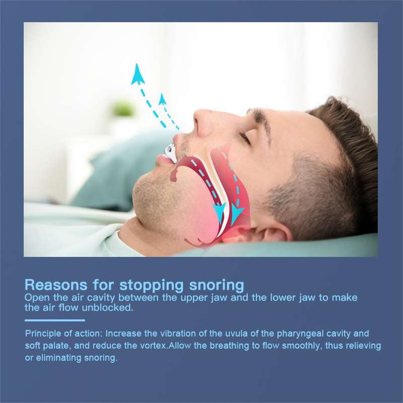 YJK100 Silicone + ABS Stop Snoring Device Anti Snore (White)