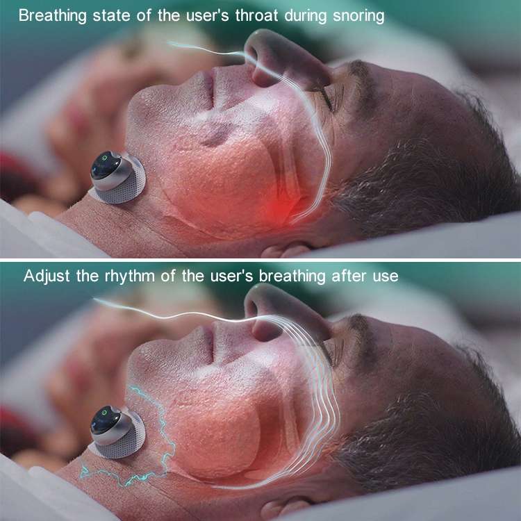 Adult Home Smart Throat Anti-snoring Device Sleep Stickers