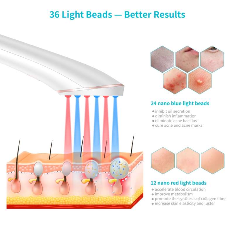 XPREEN XPRE052 Wireless Rechargeable Light Acne Treatment Device Home Acne Clearing Eraser with Blue