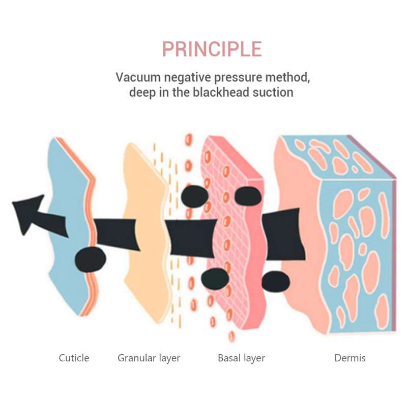 K-SKIN KD803A 3 Level Intensity Blackhead Removal Pore Cleaner Suction Rechargeable Black Spot Clean