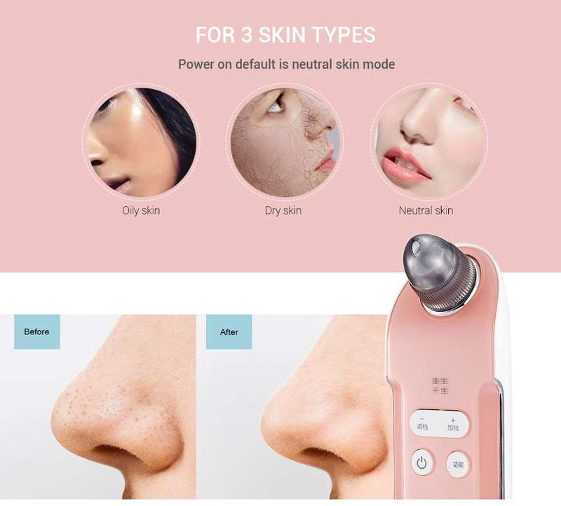 K-SKIN KD803A 3 Level Intensity Blackhead Removal Pore Cleaner Suction Rechargeable Black Spot Clean