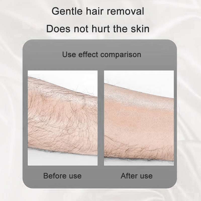 Manual Epilator Painless Skin-friendly Washable Crystal Hair Removal(Bright Golden)