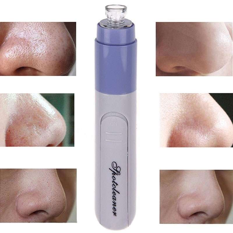Electric Facial Pore Cleaner Blackhead Remover Acne Pimple Cleanser Lifting Firming Skin