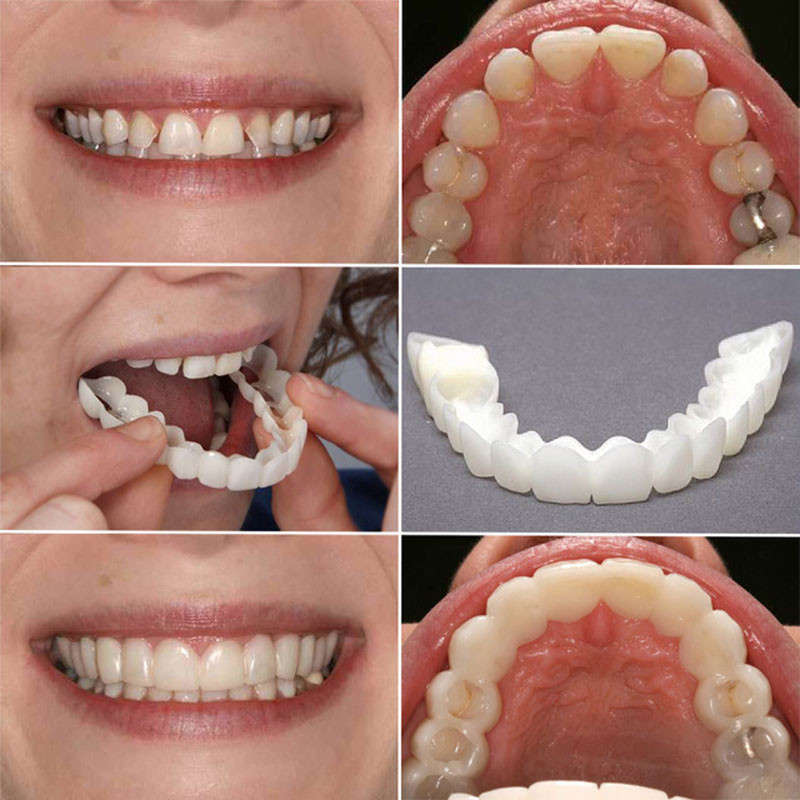 Smile Teeth Care 2nd Generation False Tooth Natural Veneer Dental Tools