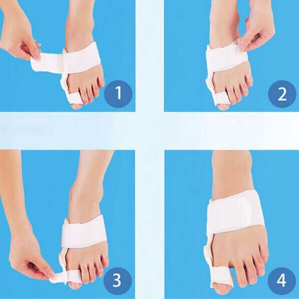 1 pcs Left Big Toe Bunion Straightener Splint Corrector