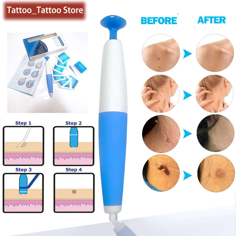 Auto Band Skin Tag Remover Kits Face Skin Care Beauty Tools Wart Remove Acne Pimple Blemish Treatmen