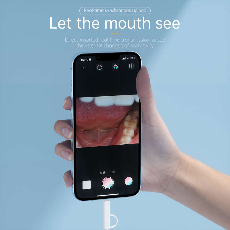 AN109 Oral Dental Intraoral Camera Apple Type-C Dentistry Endoscope 1440P 30fps 70 View 8LED Lights