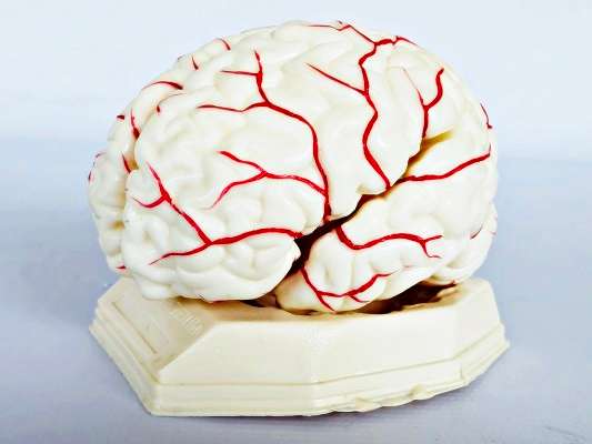 Brain Model with Arteries