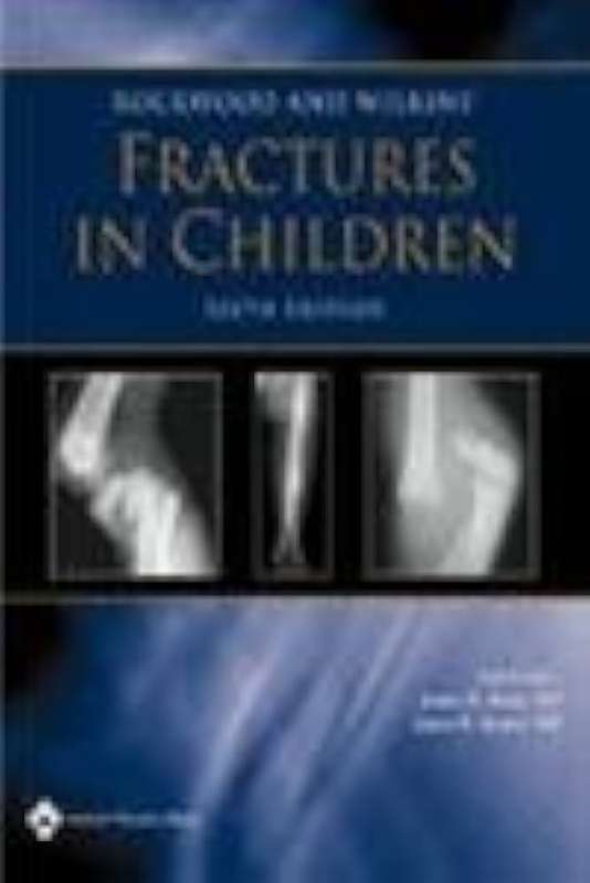 Fractures in Children
