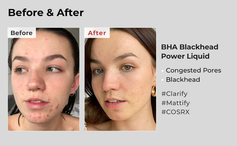 COSRX BHA Blackhead Power Liquid 100ml