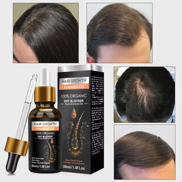 Essential Oil Biotin Cold-Pressed DHT Blocker