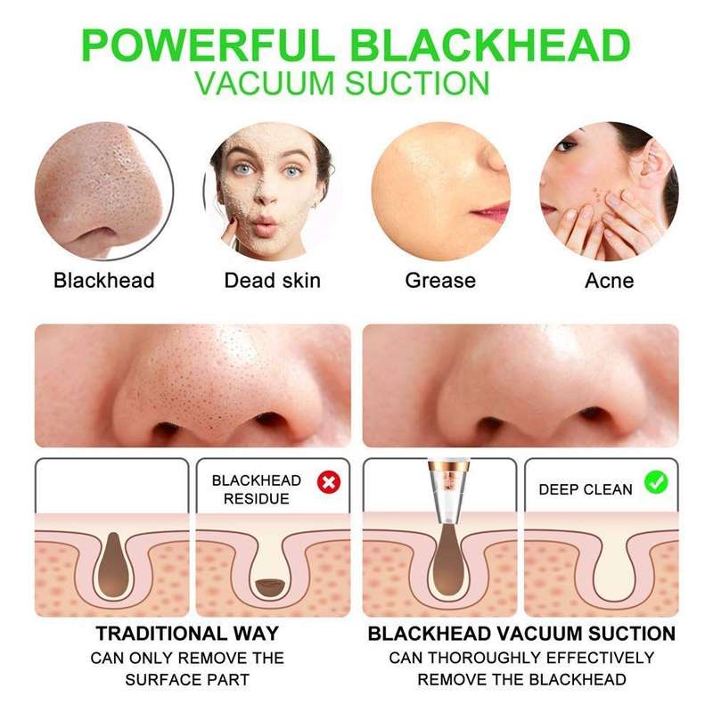 USB Rechargeable Multifunctional Blackhead Remover Vacuum Pores Cleaner