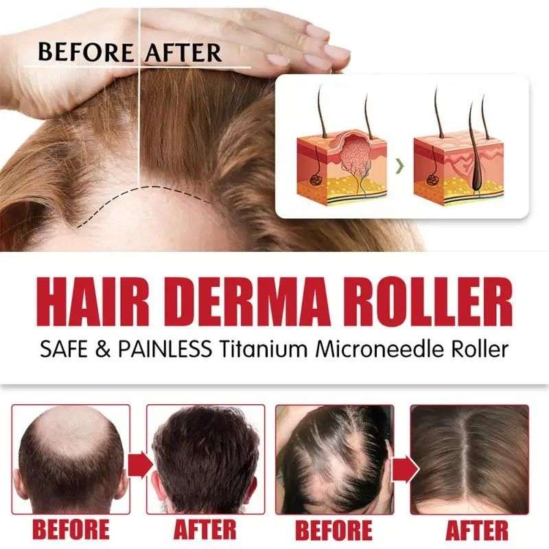 Beard Growth Oil 2 Pack + Derma Roller System Kit