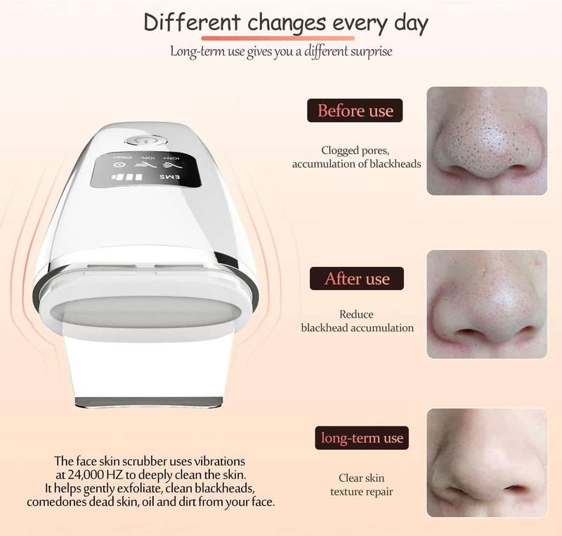 Ultrasonic Iron Facial cleansing Scrubber
