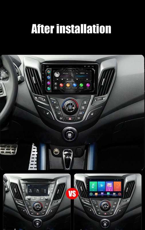 For Hyundai Veloster FS 2011-2017 DAB+ Android Auto Radio GPS Navigation CarPlay