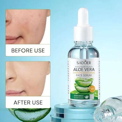 Aloe Vera Facial Serum Repairs Dry, Tired & Dehydrated Skin-30 Ml /1.0 Fl.Oz