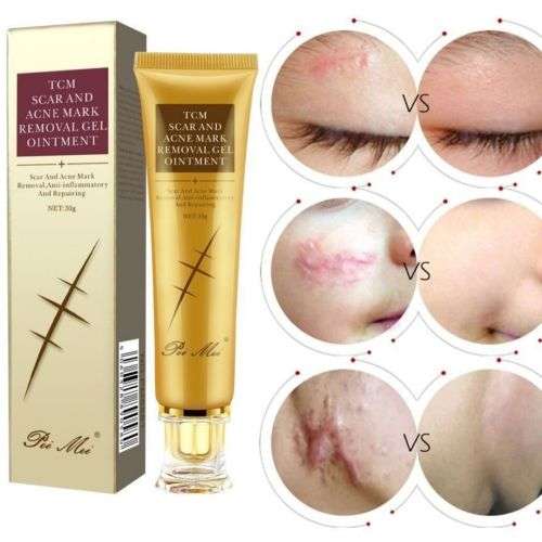 TCM SCAR AND ACNE MARK REMOVAL GEL