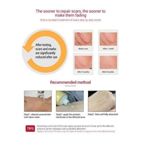 TCM SCAR AND ACNE MARK REMOVAL GEL