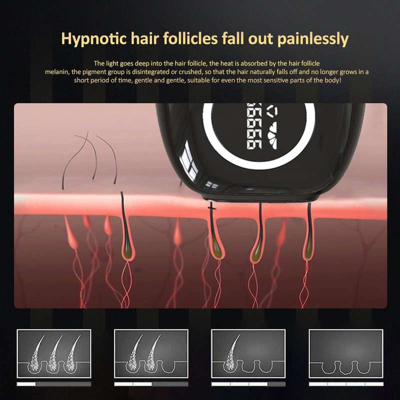 Laser hair Removal Device - IPL - For Home Use