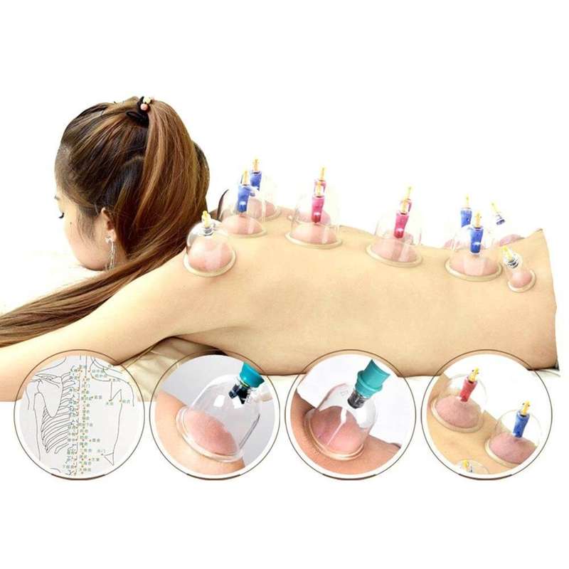 Biomagnetic Vacuum Body Cupping Therapy Set  24 Cups