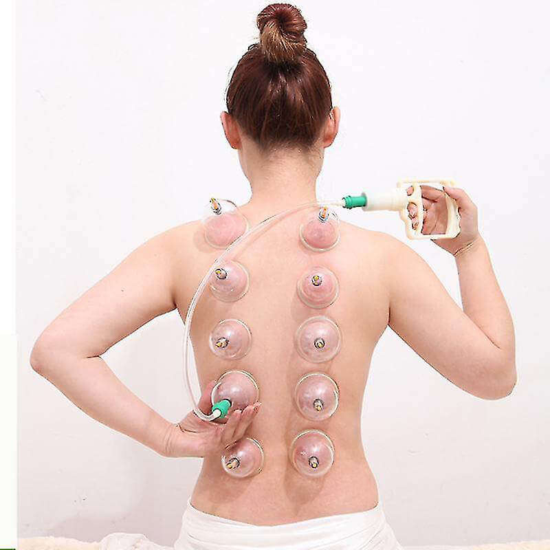 Chinese Cupping Vacuum 12pcs