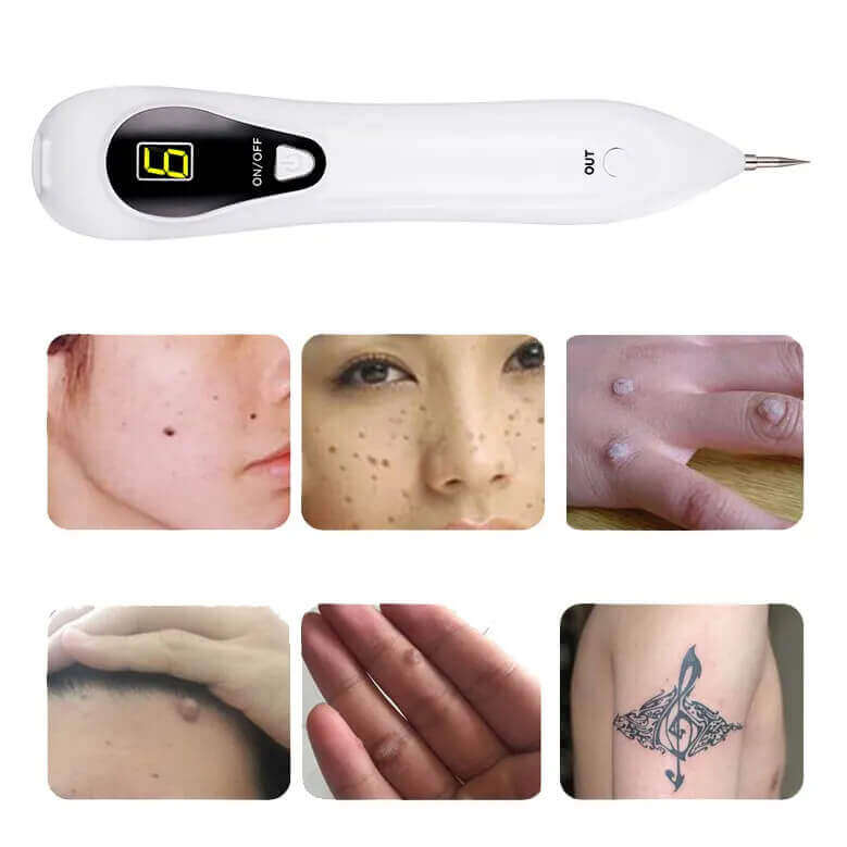 Beauty Mole Removal Sweep Spot Pen
