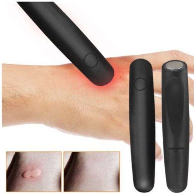 Electronic Bite Helper The Itch Terminator