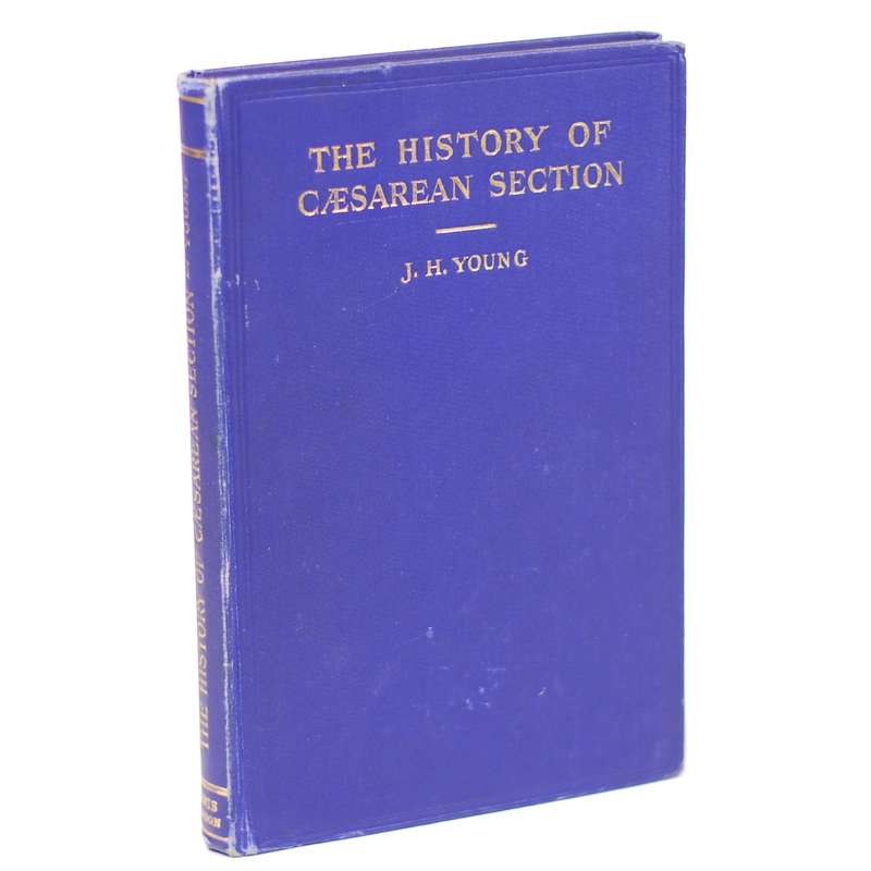 Caesarean Section. The History and Development of the Operation from Earliest Times - young, J.H.