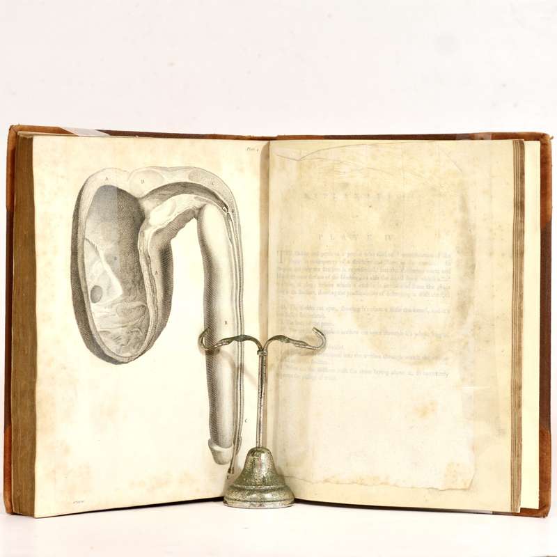 A Treatise on Venereal Disease - Hunter, John