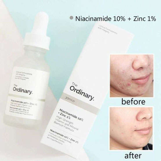 The Ordinary Niacinamide 10 % Plus Zinc 1 % 30ml