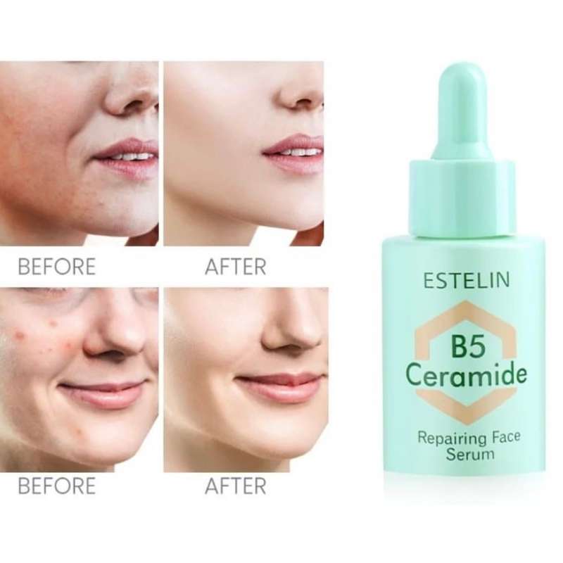 Estelin - B5 Ceramide Repairing Face Serum
