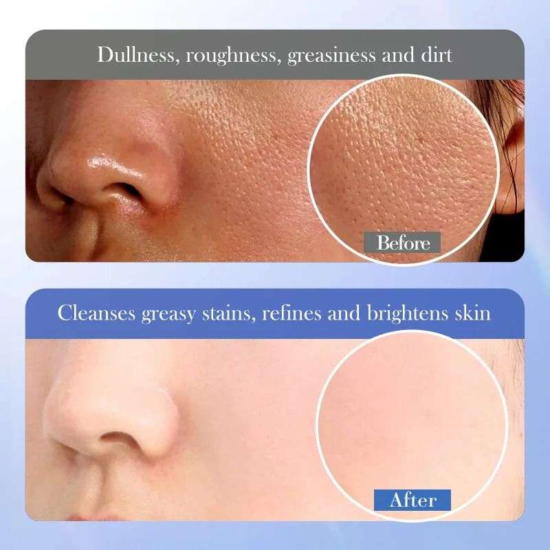 Bioaqua Ceramide Salicylic Acid Cleanser