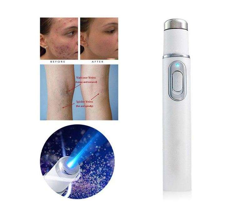 KD-7910 Blue Light Acne Laser Treatment