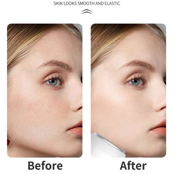 1831385 Ice Compress for Face