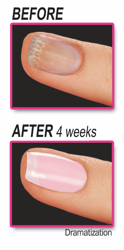 Pink Armor | Nail Care Gel