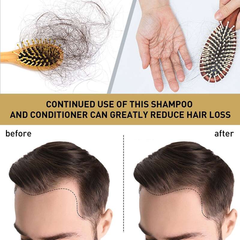 Ginger Anti-Hair Loss 100ml Thickening Conditioner Shampoo and Faster Hair Growth for Women and Men