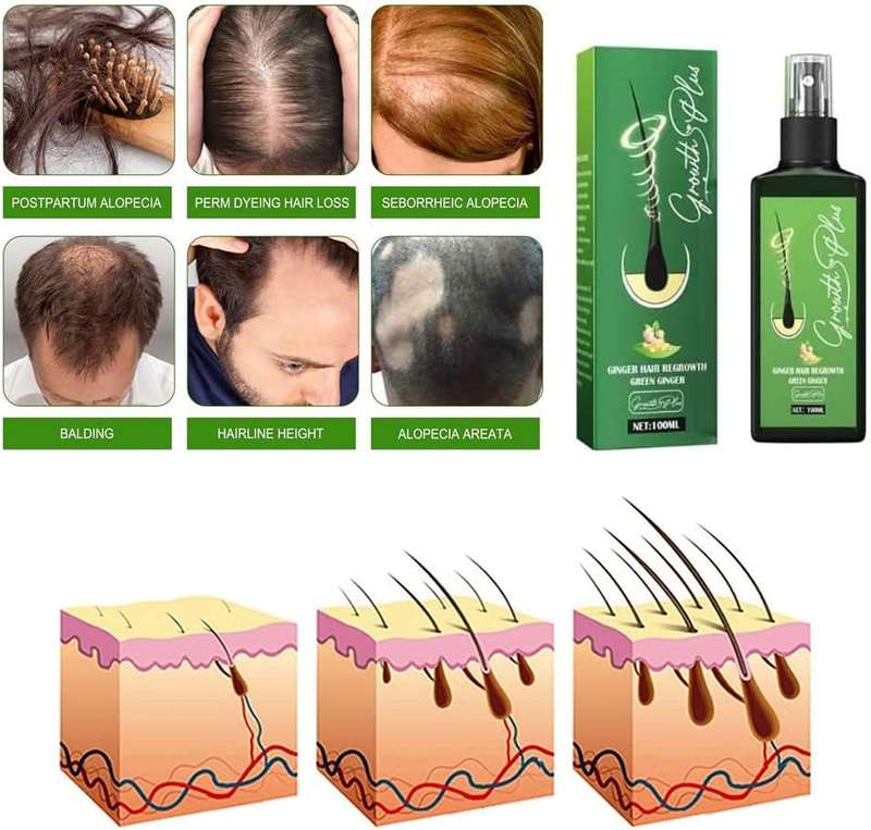Hair Spray Regrowth Nourishing Ginger Spray For Men and Women 100ml